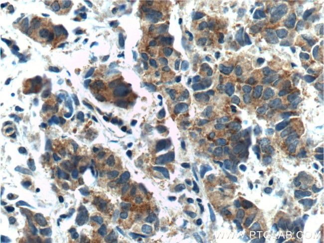 TMPRSS2 Antibody in Immunohistochemistry (Paraffin) (IHC (P))