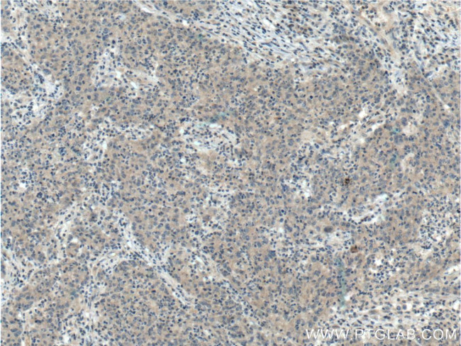 TMPRSS2 Antibody in Immunohistochemistry (Paraffin) (IHC (P))