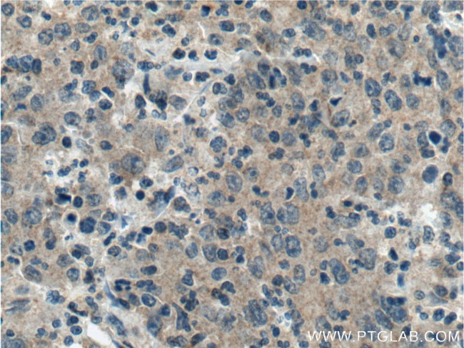 TMPRSS2 Antibody in Immunohistochemistry (Paraffin) (IHC (P))