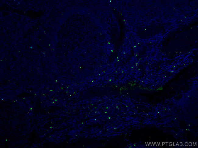 TMPRSS2 Antibody in Immunohistochemistry (PFA fixed) (IHC (PFA))