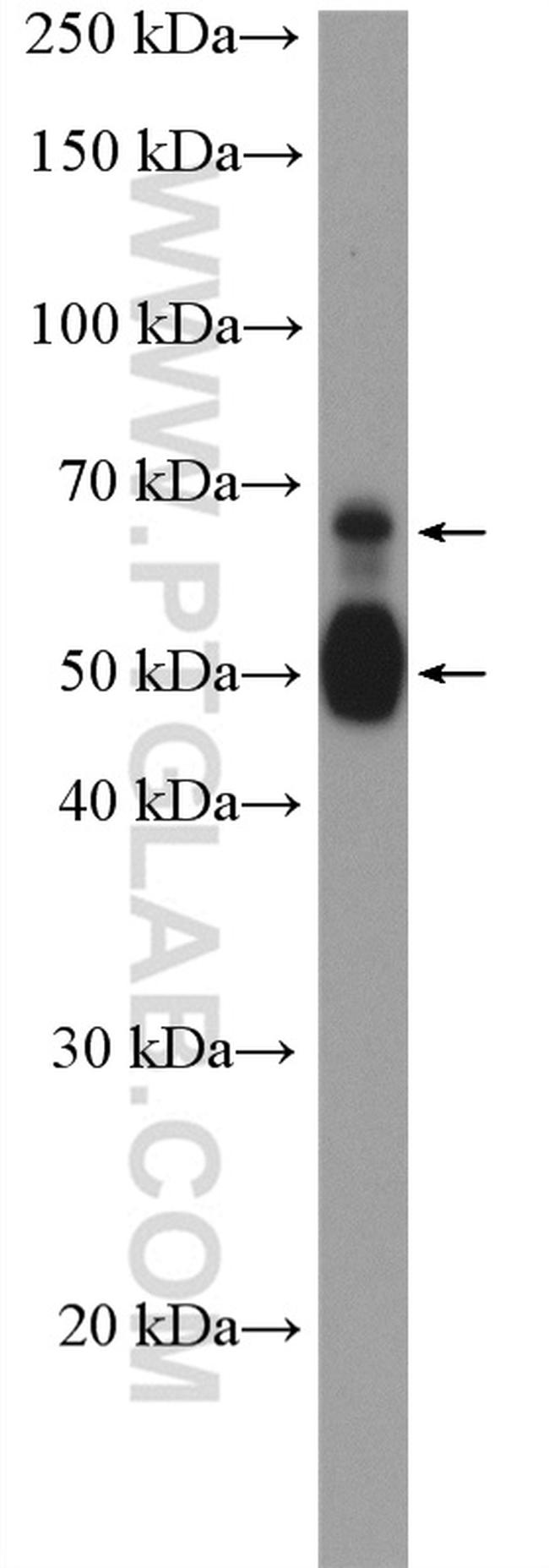 TMPRSS2 Antibody in Western Blot (WB)