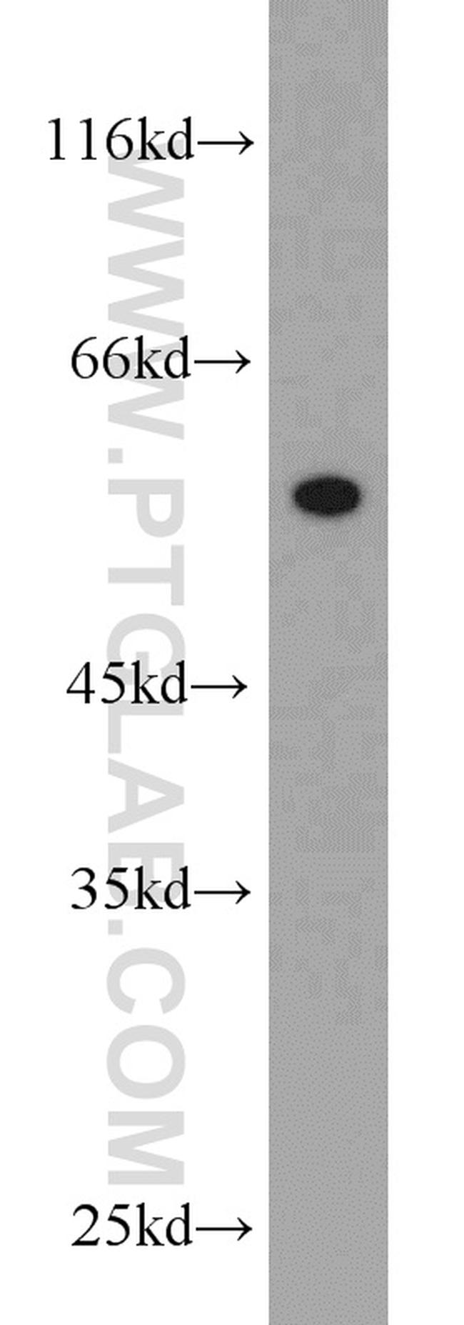 V5-tag Antibody in Western Blot (WB)