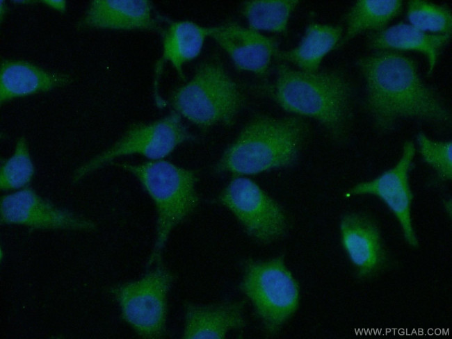 RSK3 Antibody in Immunocytochemistry (ICC/IF)