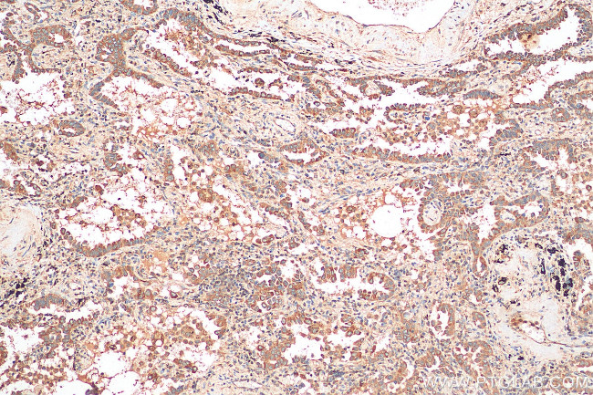 RSK3 Antibody in Immunohistochemistry (Paraffin) (IHC (P))