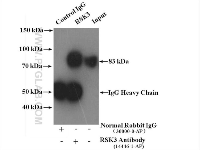 RSK3 Antibody in Immunoprecipitation (IP)