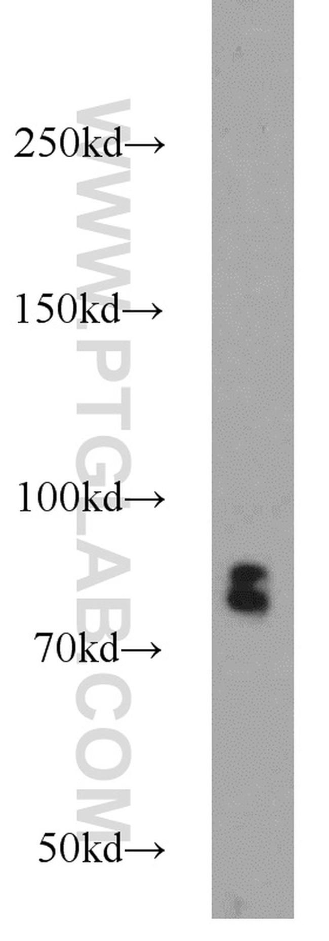 RSK3 Antibody in Western Blot (WB)