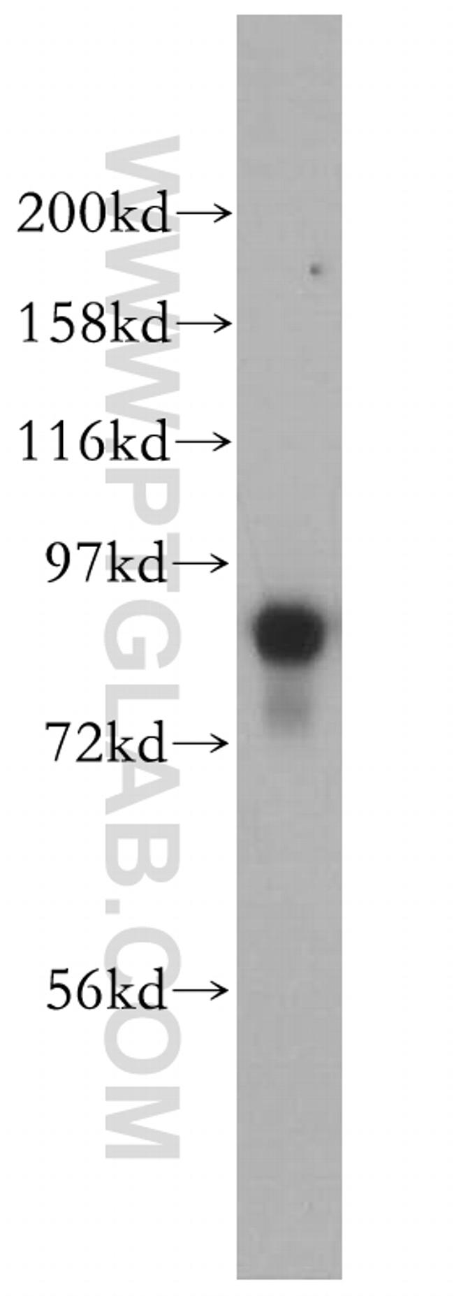 RSK3 Antibody in Western Blot (WB)