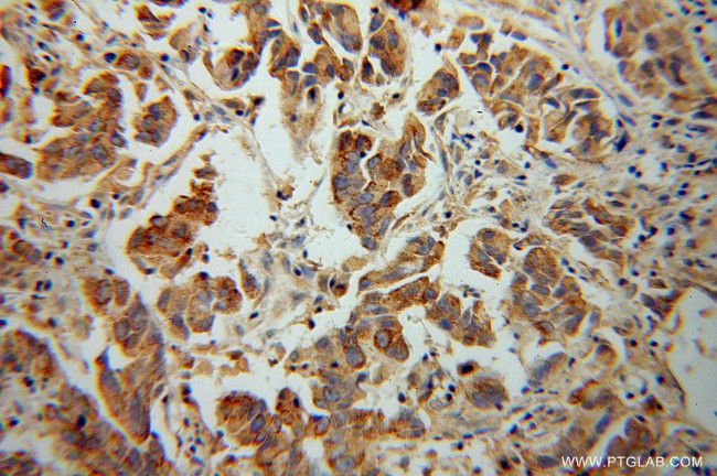 CYP17A1 Antibody in Immunohistochemistry (Paraffin) (IHC (P))