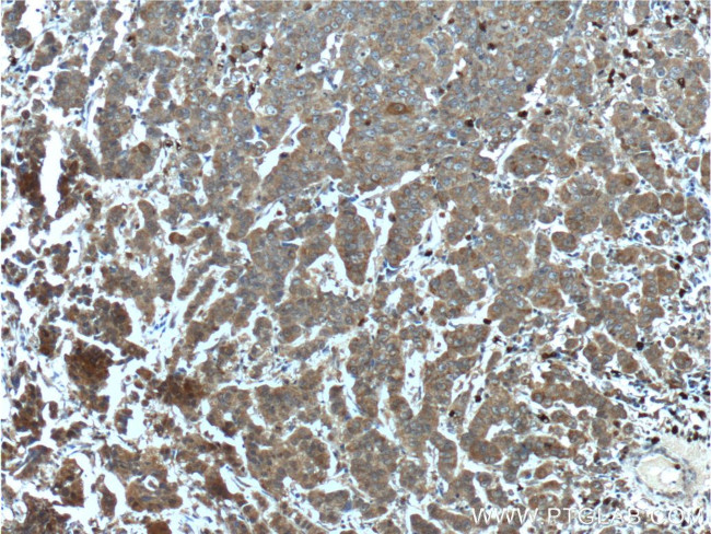 CYP17A1 Antibody in Immunohistochemistry (Paraffin) (IHC (P))