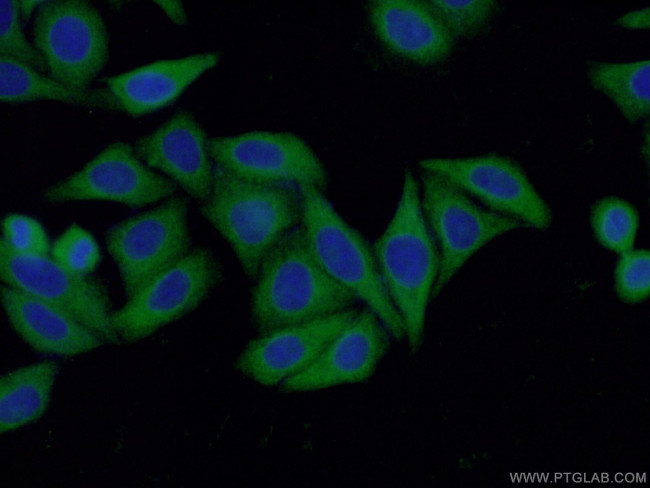 RABGGTA Antibody in Immunocytochemistry (ICC/IF)