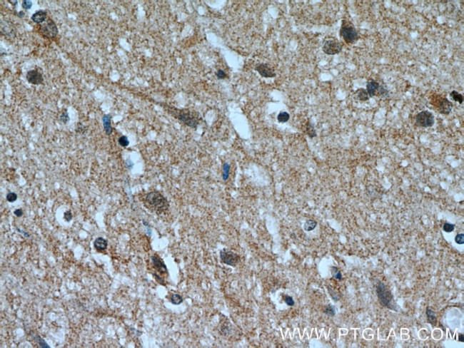 RABGGTA Antibody in Immunohistochemistry (Paraffin) (IHC (P))