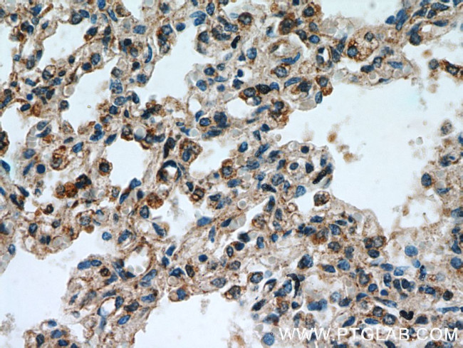 RABGGTA Antibody in Immunohistochemistry (Paraffin) (IHC (P))