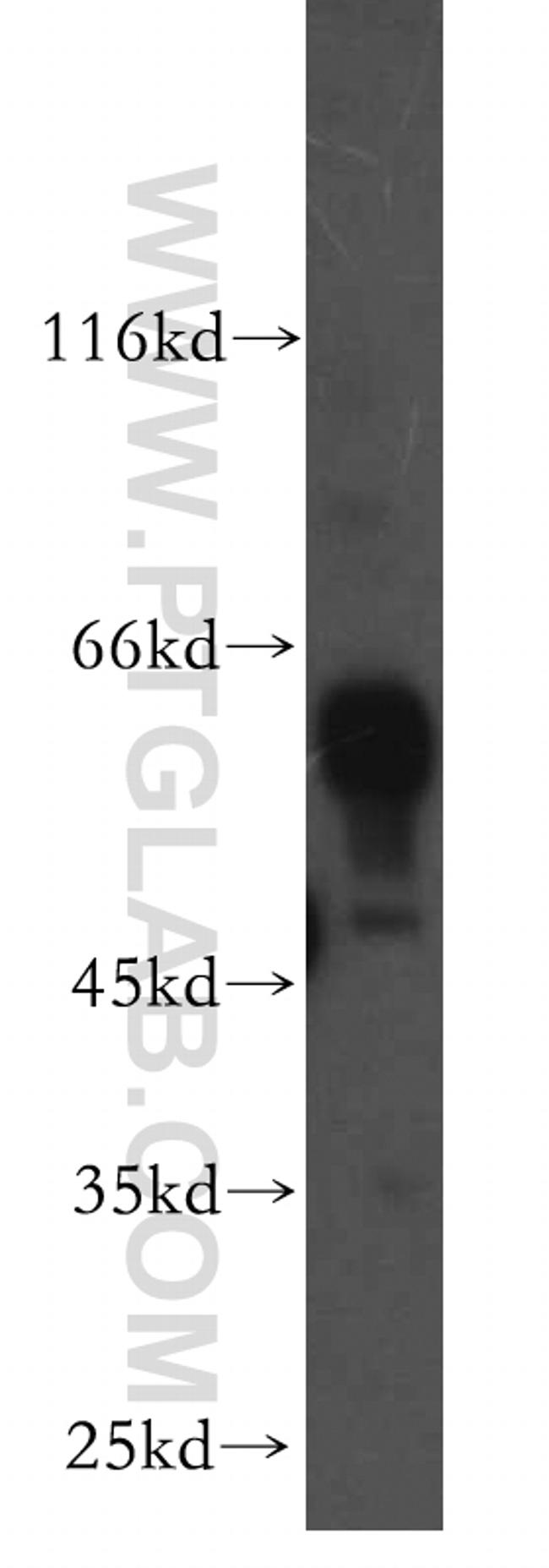 RABGGTA Antibody in Western Blot (WB)