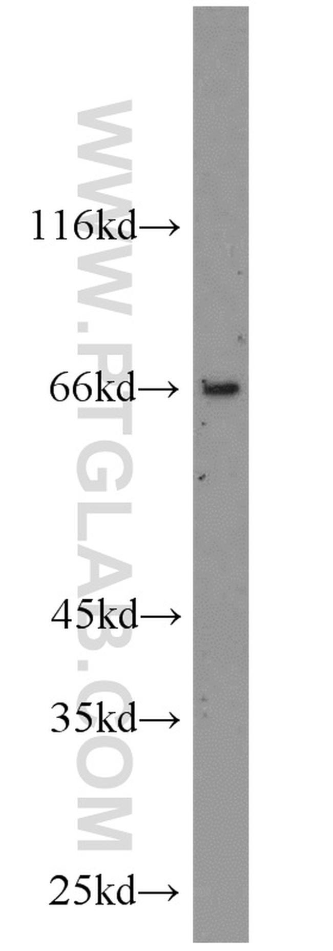 TSHR Antibody in Western Blot (WB)