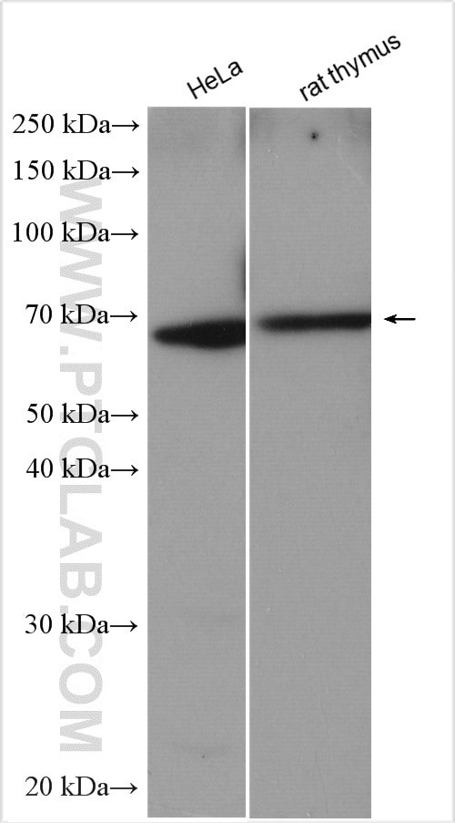 TSHR Antibody in Western Blot (WB)