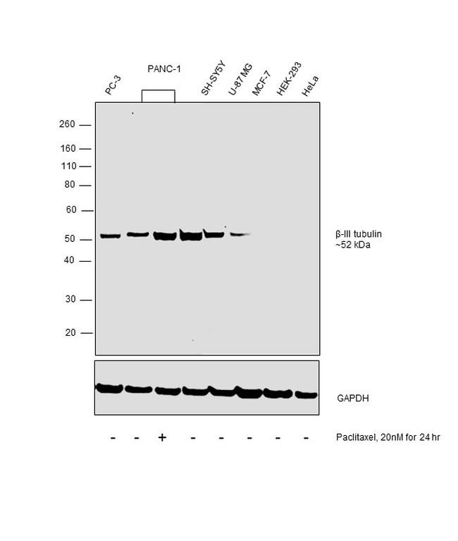 beta-3 Tubulin Antibody in Western Blot (WB)