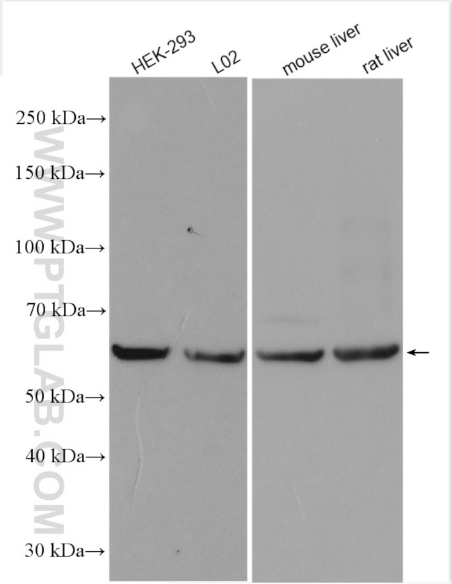 PLVAP Antibody in Western Blot (WB)