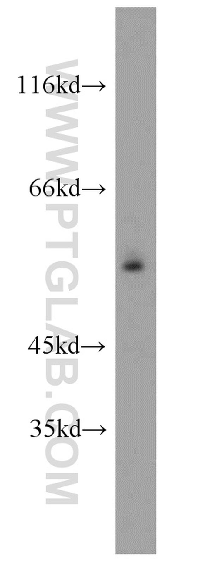 PLVAP Antibody in Western Blot (WB)