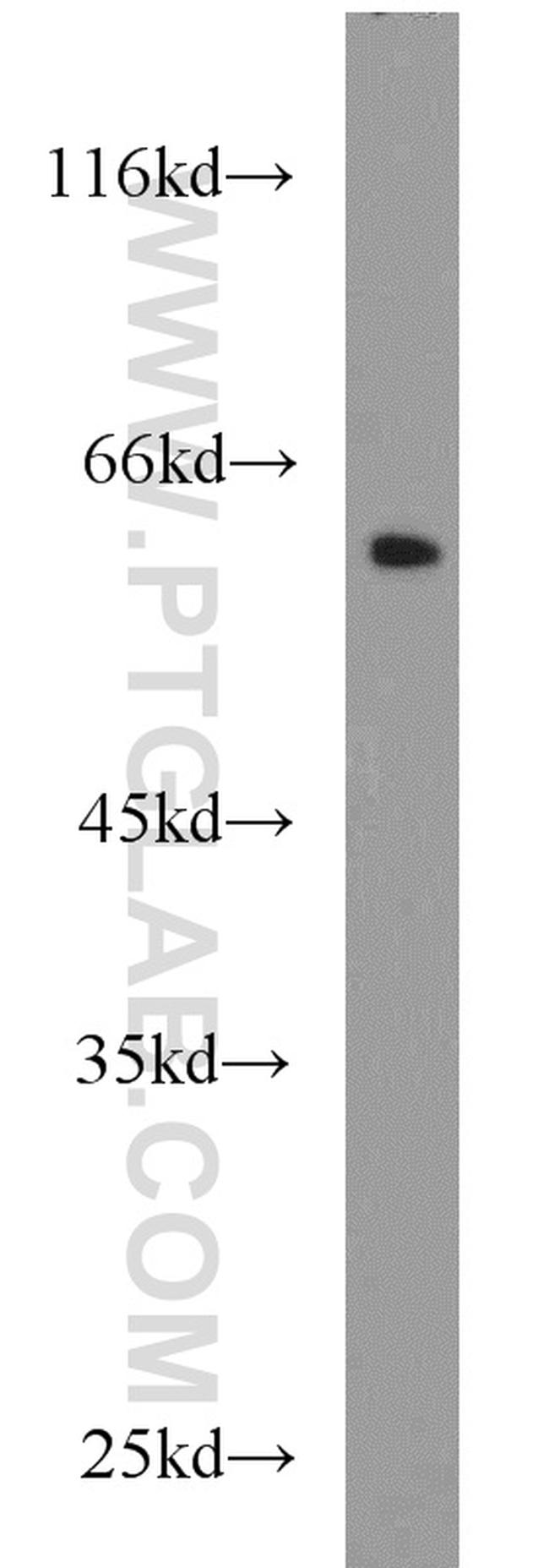 PLVAP Antibody in Western Blot (WB)