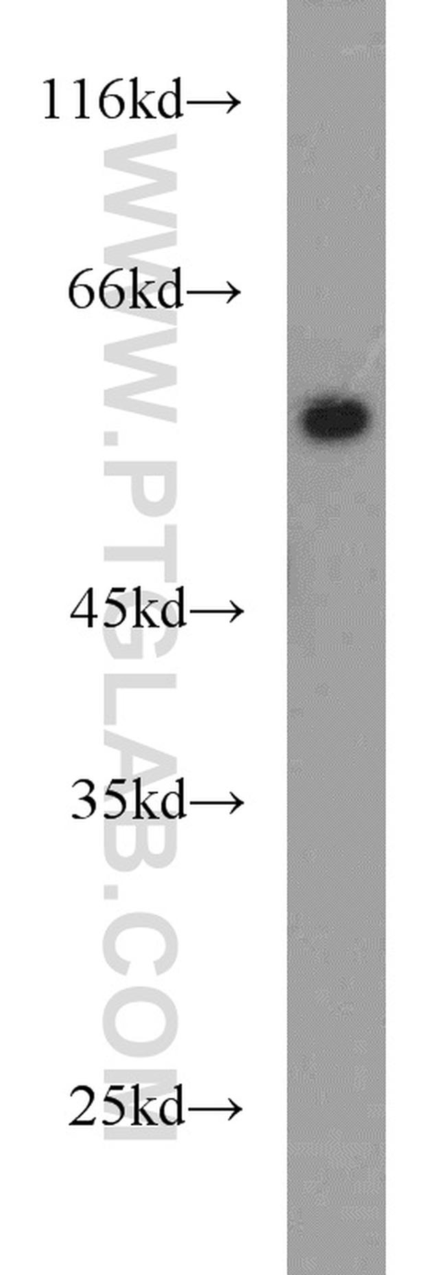 PLVAP Antibody in Western Blot (WB)