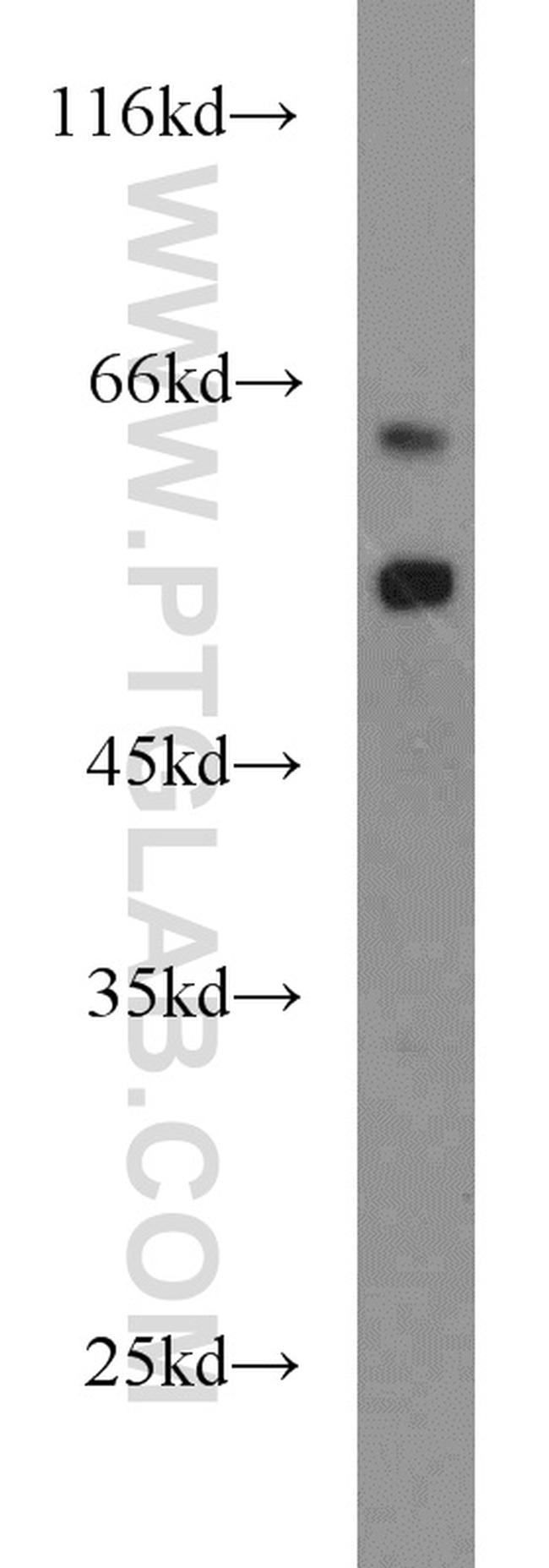 PLVAP Antibody in Western Blot (WB)