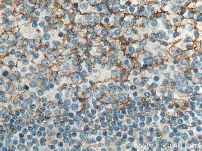 B7-H3 Antibody in Immunohistochemistry (Paraffin) (IHC (P))