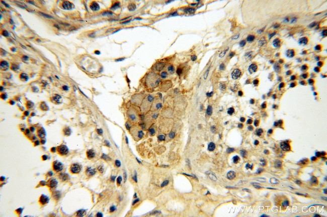 B7-H3 Antibody in Immunohistochemistry (Paraffin) (IHC (P))