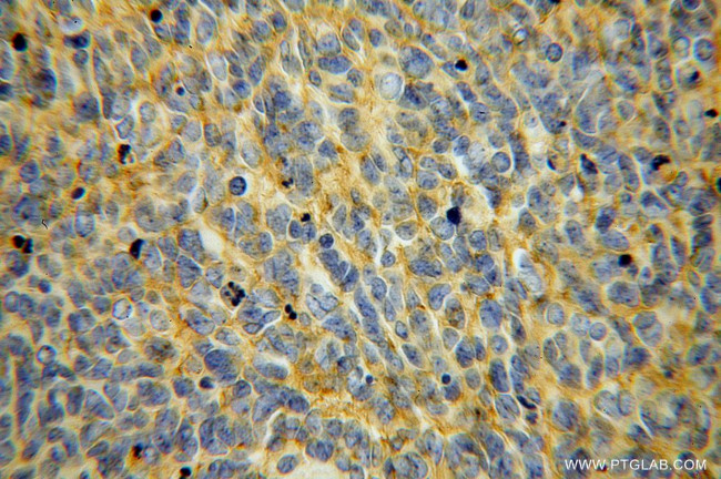 B7-H3 Antibody in Immunohistochemistry (Paraffin) (IHC (P))