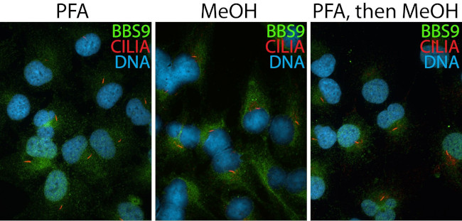 BBS9 Antibody in Immunocytochemistry (ICC/IF)