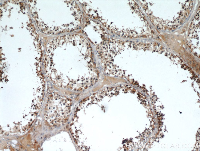 AMH Antibody in Immunohistochemistry (Paraffin) (IHC (P))