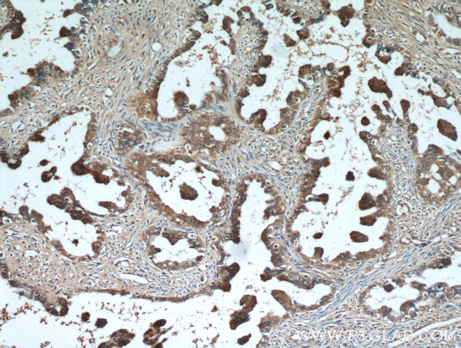 AMH Antibody in Immunohistochemistry (Paraffin) (IHC (P))