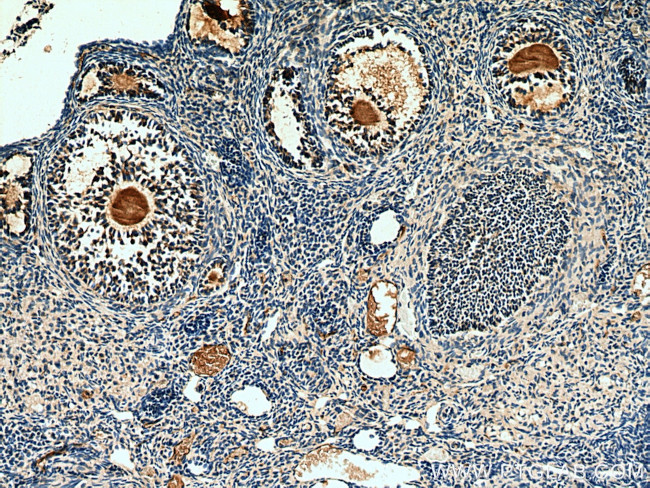 AMH Antibody in Immunohistochemistry (Paraffin) (IHC (P))