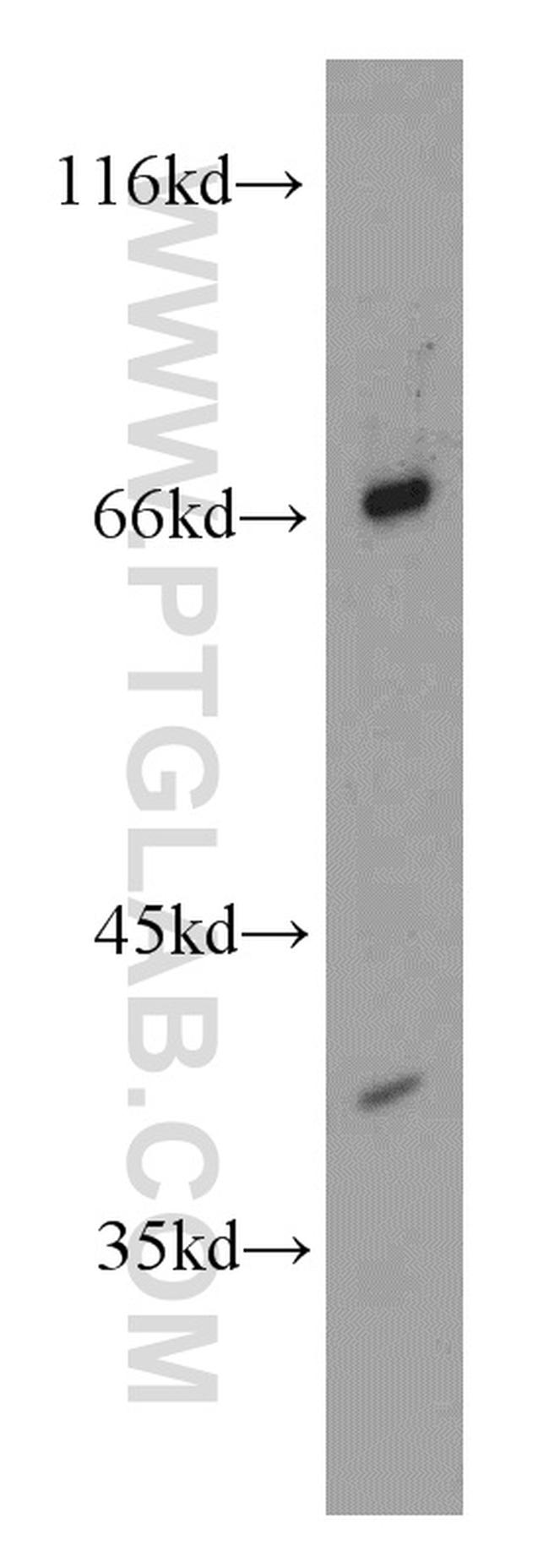 AMH Antibody in Western Blot (WB)