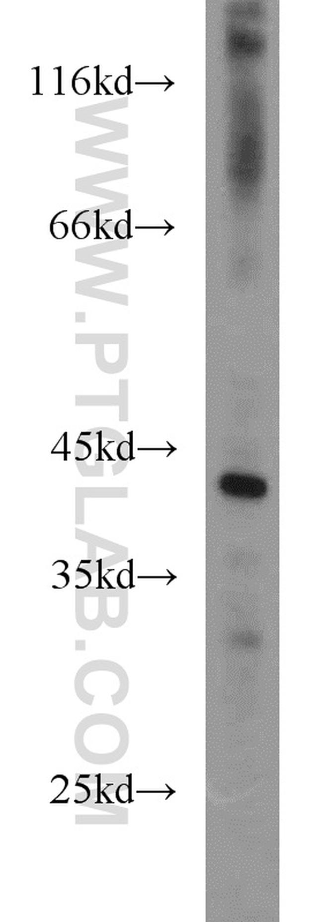 PARVB Antibody in Western Blot (WB)