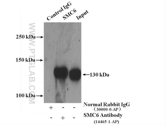 SMC6 Antibody in Immunoprecipitation (IP)