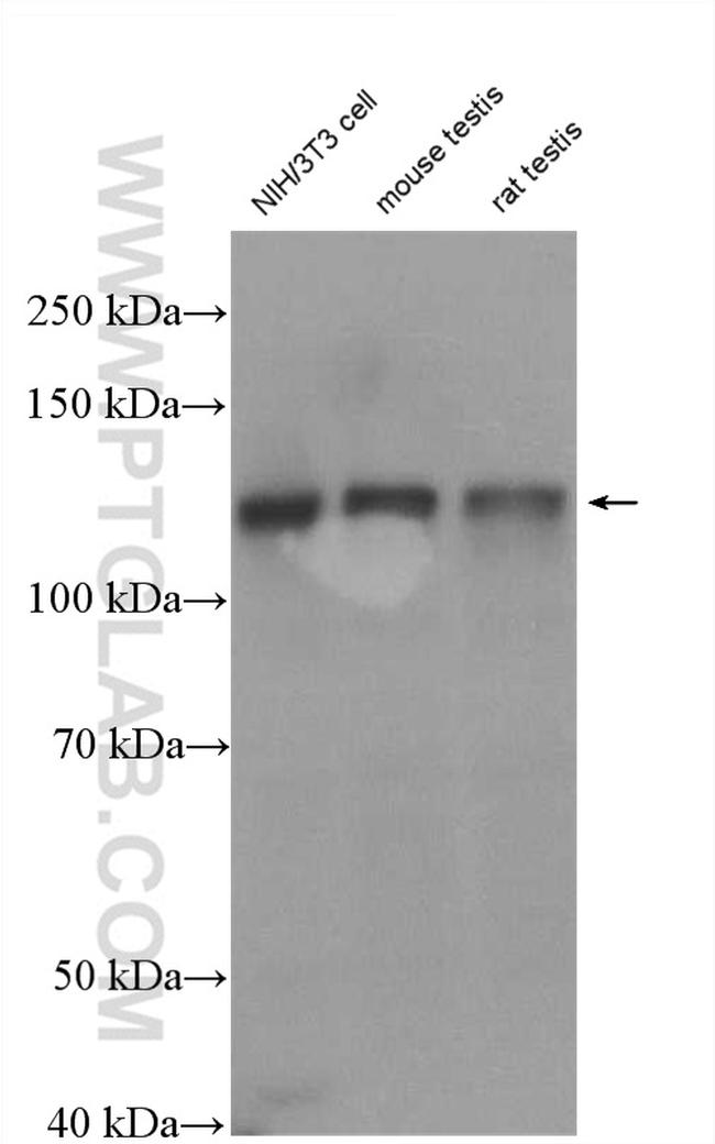 SMC6 Antibody in Western Blot (WB)