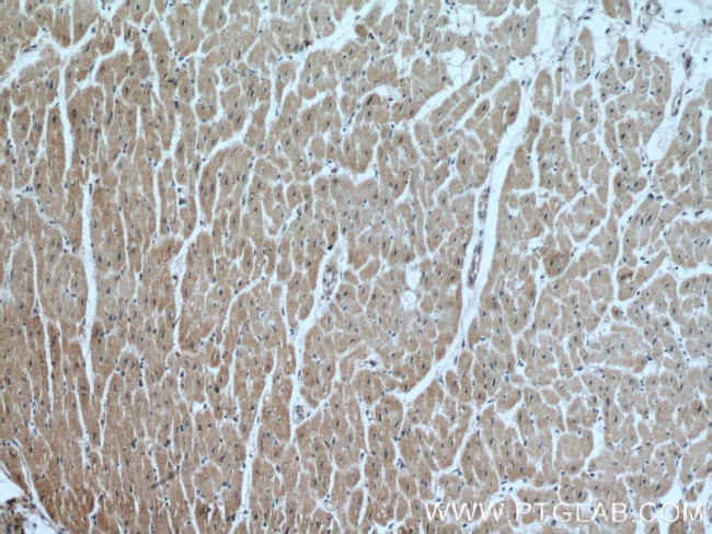 FECH Antibody in Immunohistochemistry (Paraffin) (IHC (P))