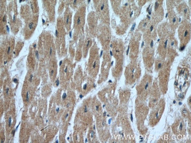 FECH Antibody in Immunohistochemistry (Paraffin) (IHC (P))