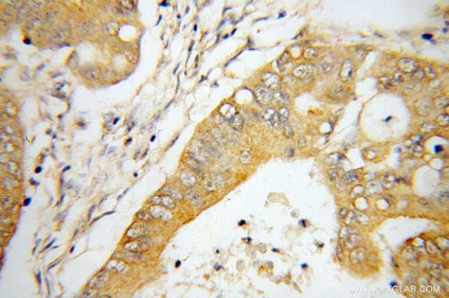 MYO7B Antibody in Immunohistochemistry (Paraffin) (IHC (P))