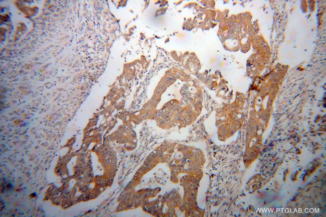 MYO7B Antibody in Immunohistochemistry (Paraffin) (IHC (P))