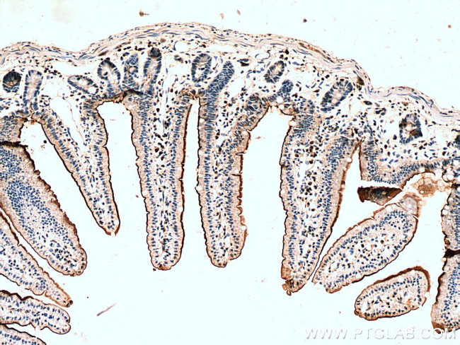 MYO7B Antibody in Immunohistochemistry (Paraffin) (IHC (P))