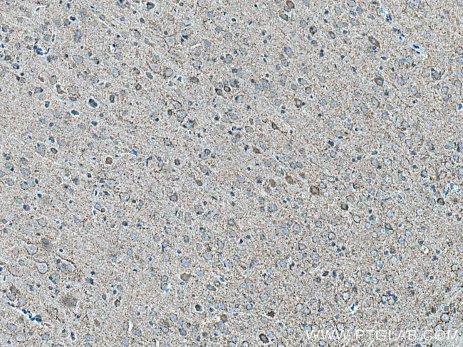 VGAT Antibody in Immunohistochemistry (Paraffin) (IHC (P))