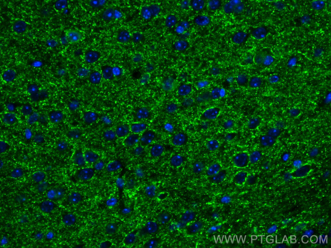 VGAT Antibody in Immunohistochemistry (PFA fixed) (IHC (PFA))