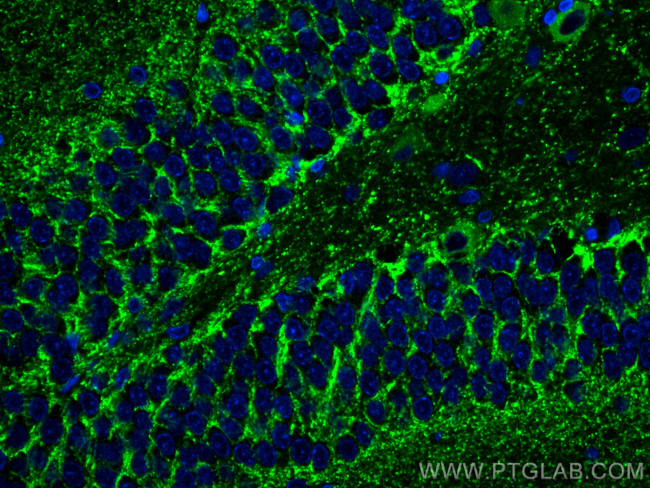 VGAT Antibody in Immunohistochemistry (PFA fixed) (IHC (PFA))