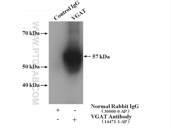 VGAT Antibody in Immunoprecipitation (IP)