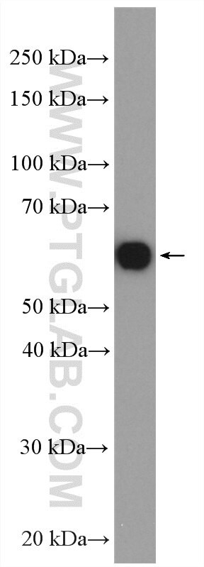 VGAT Antibody in Western Blot (WB)