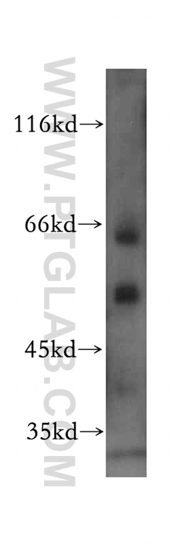 VGAT Antibody in Western Blot (WB)