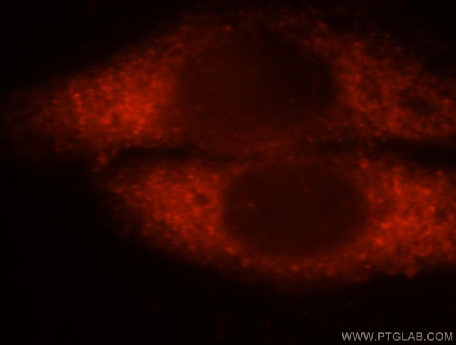 GSTA1 Antibody in Immunocytochemistry (ICC/IF)