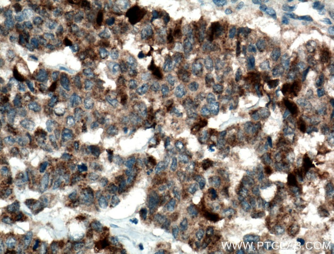 GSTA1 Antibody in Immunohistochemistry (Paraffin) (IHC (P))