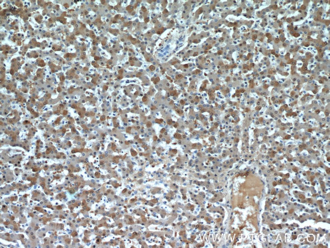 GSTA1 Antibody in Immunohistochemistry (Paraffin) (IHC (P))